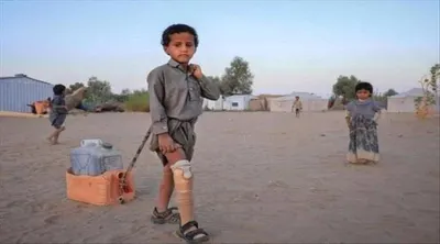 اخبار اليمن الان الحدث اليوم عاجل 