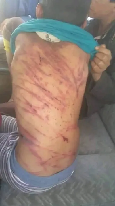 اخبار اليمن الان استنكار واسع تداول بطريقة وحشية اخبار اليمن الان الحدث اليوم عاجل