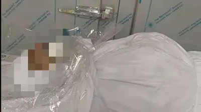 اخبار اليمن الان قناص حو يستهدف مواطن بتعز اخبار اليمن الان الحدث اليوم عاجل