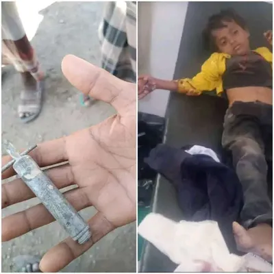 اخبار اليمن الان الحدث اليوم عاجل 