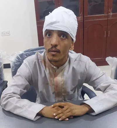 اخبار اليمن الان تصريح للشاب المعتدى العروض ماحدث اخبار اليمن الان الحدث اليوم عاجل