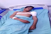 عدن تايم اخبار اليمن الان إصابة عشوائي مليشيا الحوثي المسيمير اخبار اليمن الان الحدث اليوم عاجل عدن تايم