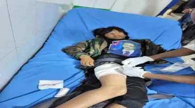 اخبار اليمن الان الحدث اليوم عاجل 