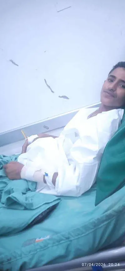 اخبار اليمن الان الحدث اليوم عاجل 