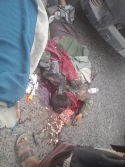 اخبار اليمن الان مصير محزن لملك الشقلبة مشهد اخبار اليمن الان الحدث اليوم عاجل