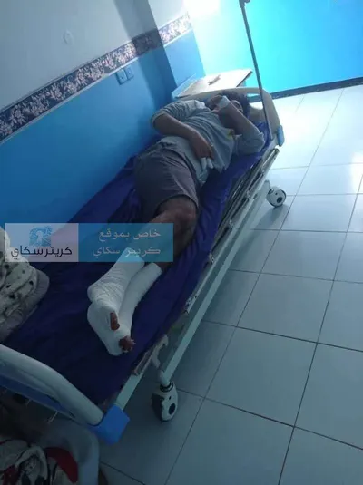 اخبار اليمن الان الحدث اليوم عاجل 