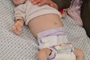 وكالة الصحافة اليمنية اخبار اليمن الان تفاقم التغذية فلسطينية بقافلة المجاعة اخبار اليمن الان الحدث اليوم عاجل وكالة الصحافة اليمنية