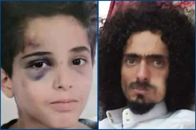 اخبار اليمن الان الكشف تفاصيل مروعة لاعتداء صنعاء اخبار اليمن الان الحدث اليوم عاجل