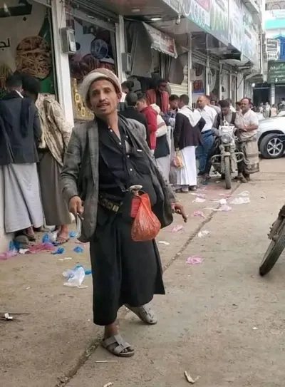 اخبار اليمن الان مصير محزن لملك الشقلبة مشهد اخبار اليمن الان الحدث اليوم عاجل