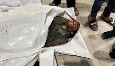اخبار اليمن الان شهيدا وجريحا مستشفيات الـ48 الماضية اخبار اليمن الان الحدث اليوم عاجل