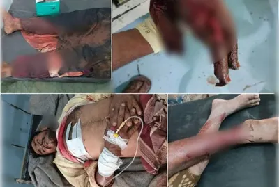 اخبار اليمن الان انفجار حوثي يصيب مدنيين الحديدة اخبار اليمن الان الحدث اليوم عاجل