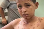 صحيفة الثورة صنعاء اخبار اليمن الان البرش الماء يتحول تسجيل إصابة اخبار اليمن الان الحدث اليوم عاجل صحيفة الثورة صنعاء