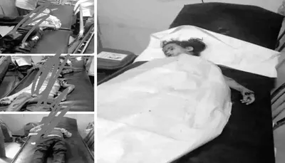 اخبار اليمن الان تفاصيل لفاجعة الضالع الأطفال الريبي اخبار اليمن الان الحدث اليوم عاجل