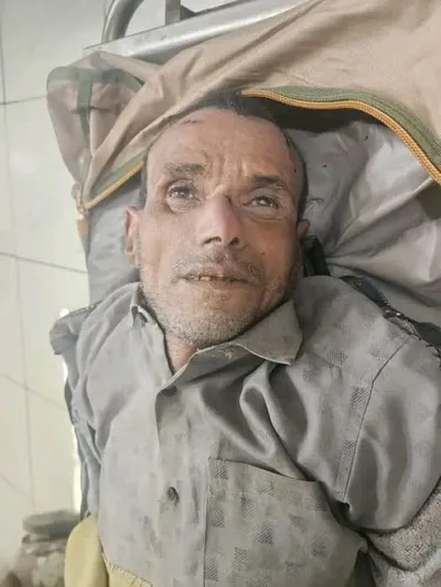 اخبار اليمن الان الحدث اليوم عاجل 