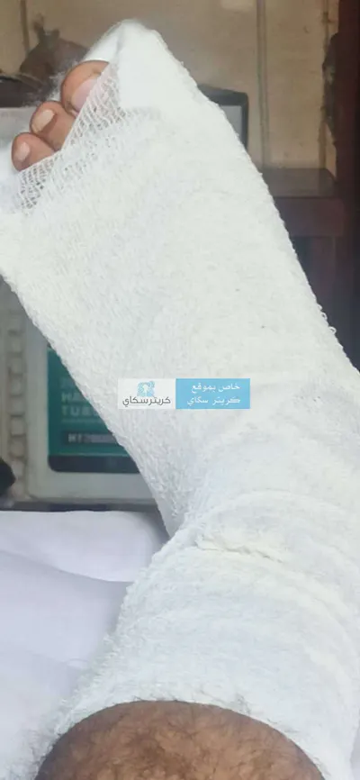 اخبار اليمن الان تقتحم منزلا وتتسبب ومناشدة للمحافظ اخبار اليمن الان الحدث اليوم عاجل