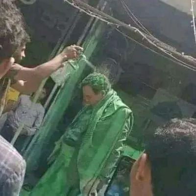 اخبار اليمن الان فقدان المهمشين كيمائية الدهان الأخضر اخبار اليمن الان الحدث اليوم عاجل