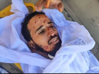 اخبار اليمن الان الحدث اليوم عاجل 