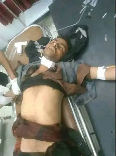 اخبار اليمن الان لمرتكب جريمة القات اصابته باشتباكات اخبار اليمن الان الحدث اليوم عاجل