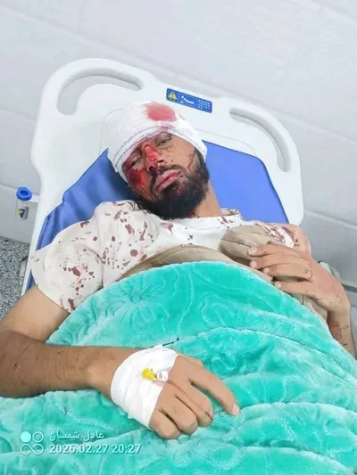 اخبار اليمن الان الحدث اليوم عاجل 