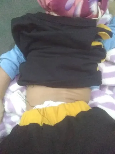 اخبار اليمن الان إصابة مواطنين وامرأة لمليشيات الحوثي اخبار اليمن الان الحدث اليوم عاجل