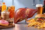 صحيفة المرصد اخبار اليمن الان المشروبات المحلاة والوجبات السريعة الكبد اخبار اليمن الان الحدث اليوم عاجل صحيفة المرصد