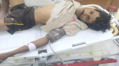 اخبار اليمن الان الحدث اليوم عاجل 