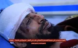 اخبار اليمن الان الحدث اليوم عاجل وكالة الصحافة اليمنية