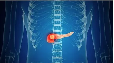 اخبار اليمن الان استشاري أعراض لمشكلات البنكرياس الجسم اخبار اليمن الان الحدث اليوم عاجل