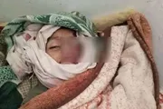 اخبار اليمن الان الحدث اليوم عاجل كريتر إسكاي
