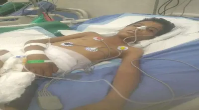 اخبار اليمن الان استشهاد متأثرا بإصابته برصاص قناص اخبار اليمن الان الحدث اليوم عاجل