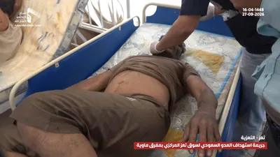 اخبار اليمن الان ومشاهد الجريمة السعودية المدنيين بمحافظة اخبار اليمن الان الحدث اليوم عاجل