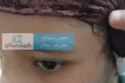 كريتر إسكاي اخبار اليمن الان مروعة تعرض طفلة لتعذيب أبيها اخبار اليمن الان الحدث اليوم عاجل كريتر إسكاي