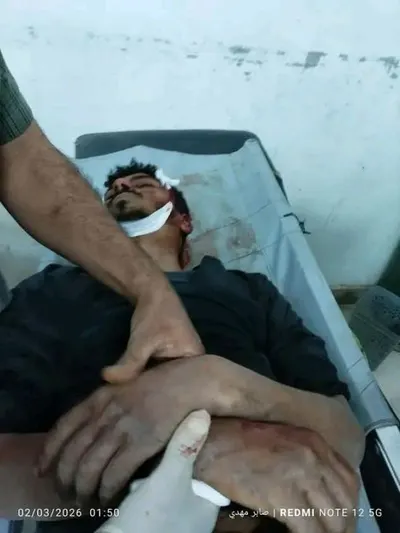 اخبار اليمن الان الحدث اليوم عاجل 