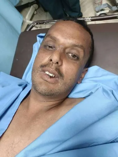 اخبار اليمن الان تعرضه لحادث حديقة للتعرف مجهول اخبار اليمن الان الحدث اليوم عاجل