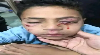 اخبار اليمن الان الألعاب النارية وانتشارها الأطفال والأعياد اخبار اليمن الان الحدث اليوم عاجل