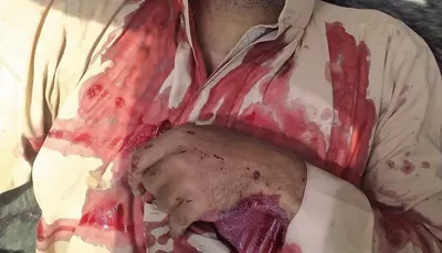 اخبار اليمن الان وجهاء قبائل عبيدة برصاص الإصلاح اخبار اليمن الان الحدث اليوم عاجل