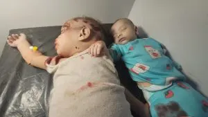 اخبار اليمن الان مجزرة سعودية جديدة الأطفال والنساء اخبار اليمن الان الحدث اليوم عاجل