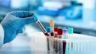 اخبار اليمن الان مرحلة فحوصات الحفاظ والوقاية الأمراض اخبار اليمن الان الحدث اليوم عاجل