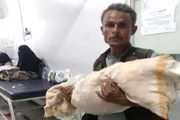صحيفة المرصد اخبار اليمن الان الطفلة صفية ضحايا الإخوان بمستشفيات اخبار اليمن الان الحدث اليوم عاجل صحيفة المرصد