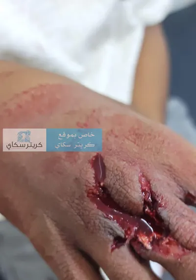 اخبار اليمن الان الحدث اليوم عاجل 