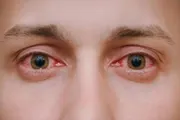 عاجل السعودية اخبار اليمن الان طبيبة فيتامينات تناولها لصحة العيون اخبار اليمن الان الحدث اليوم عاجل عاجل السعودية