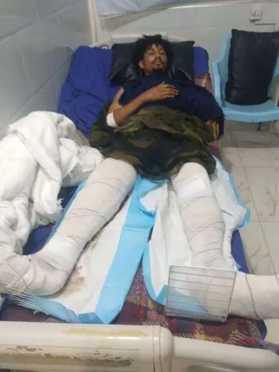 اخبار اليمن الان بحالة يحتاج لعملية وأسرته المساعدة اخبار اليمن الان الحدث اليوم عاجل