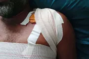 اخبار اليمن الان الحدث اليوم عاجل كريتر إسكاي