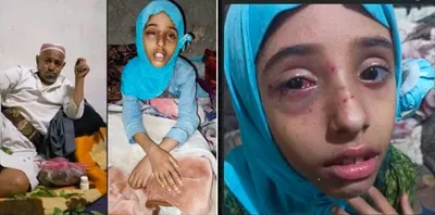 اخبار اليمن الان اعتداء مروع طفلة ووالدتها أطفال اخبار اليمن الان الحدث اليوم عاجل