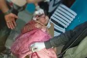 وكالة 2 ديسمبر اخبار اليمن الان استشهاد مدني وإصابة وامرأة الموادم اخبار اليمن الان الحدث اليوم عاجل وكالة 2 ديسمبر