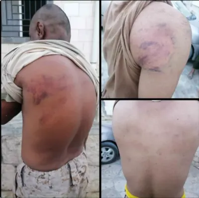 اخبار اليمن الان الحدث اليوم عاجل 