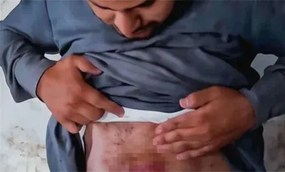 اخبار اليمن الان تعذيب مواطن بصعدة مطالبات بالكشف اخبار اليمن الان الحدث اليوم عاجل