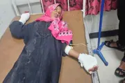 صدى الساحل اخبار اليمن الان إصابة طفلة انفجار حوثي الكدحة اخبار اليمن الان الحدث اليوم عاجل صدى الساحل