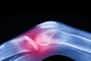 عدن تايم اخبار اليمن الان افضل خضار سحري لكبار السن اخبار اليمن الان الحدث اليوم عاجل عدن تايم