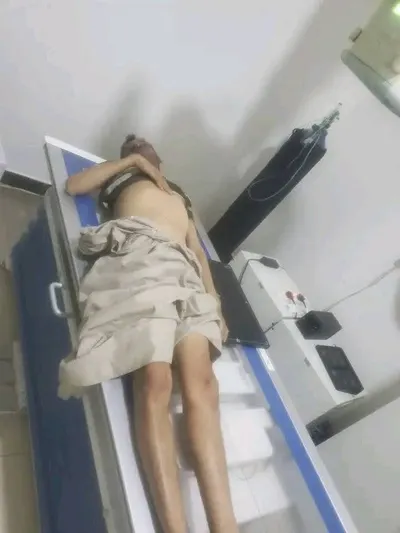 اخبار اليمن الان الحدث اليوم عاجل 